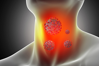 Salivary Gland Cancer Surgeon in Vijayawada